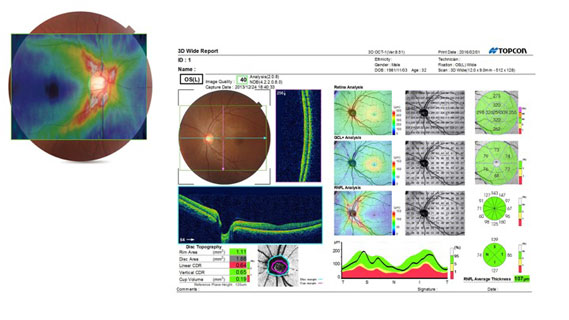 Maestro 12 x 9 widefield scan report