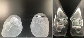 Weightbearing imaging