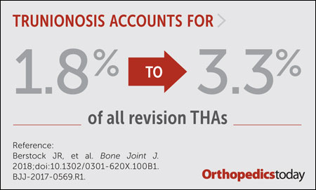 Trunionosis graphic